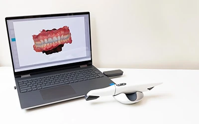 intraoral camera used at Pendleton Smiles